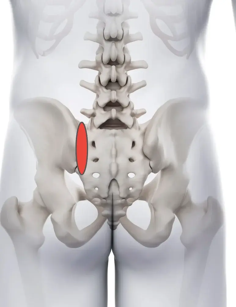 仙腸関節性腰痛